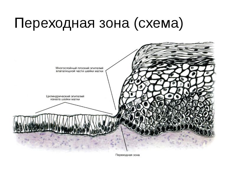 Схема шейки матки