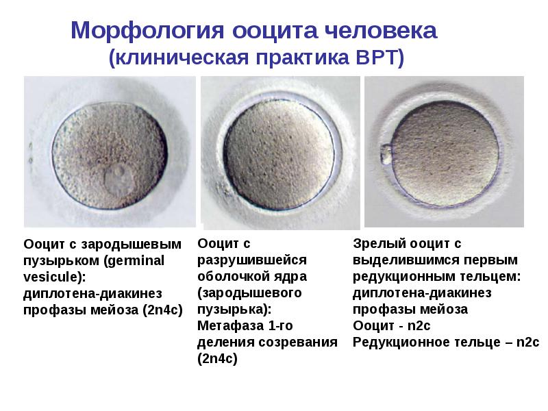 Ооциты деление. Ооцит. Ооциты человека. Стадии зрелости ооцитов. Зрелый ооцит.