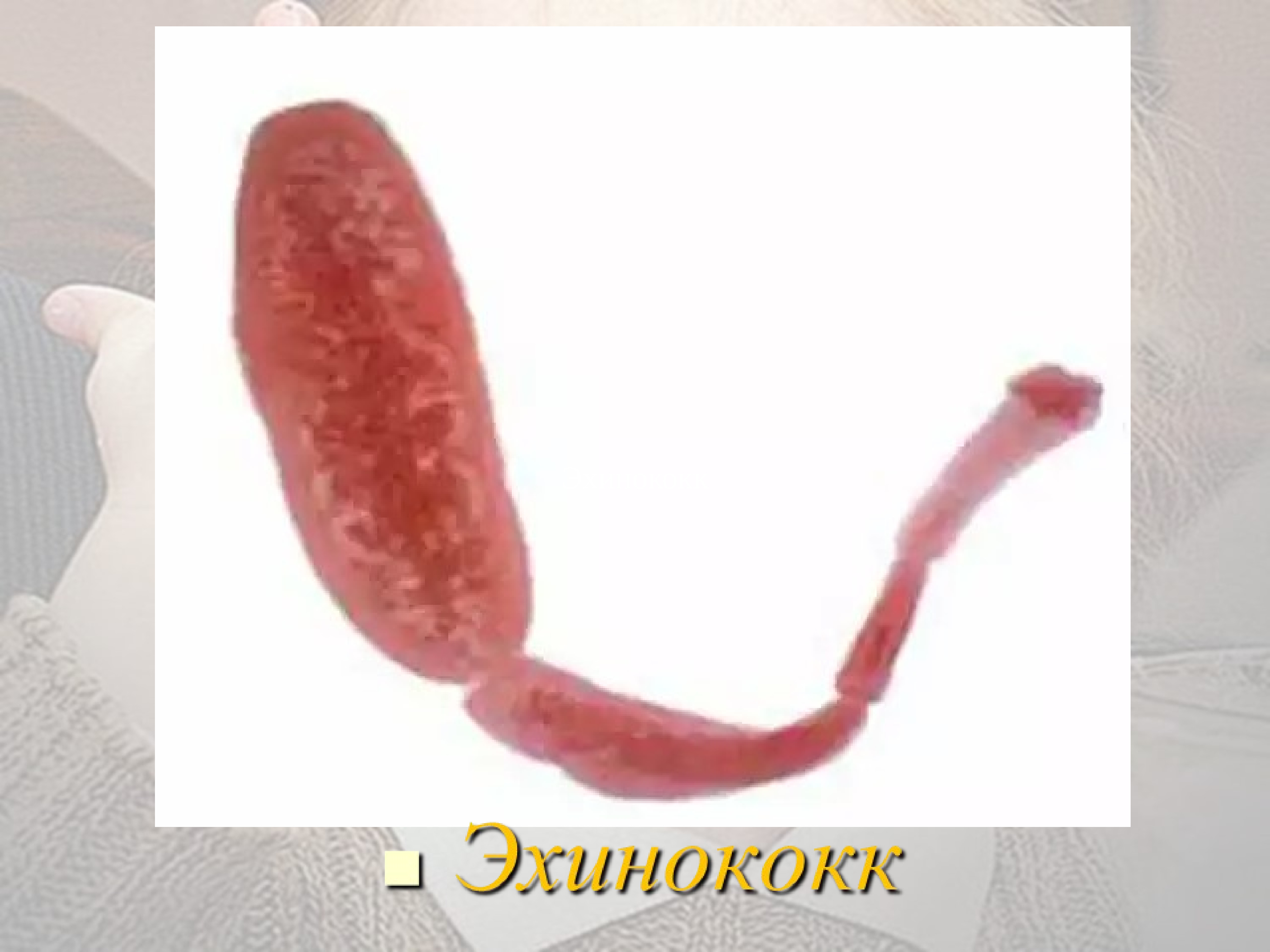 Яйца Эхинококка Фото