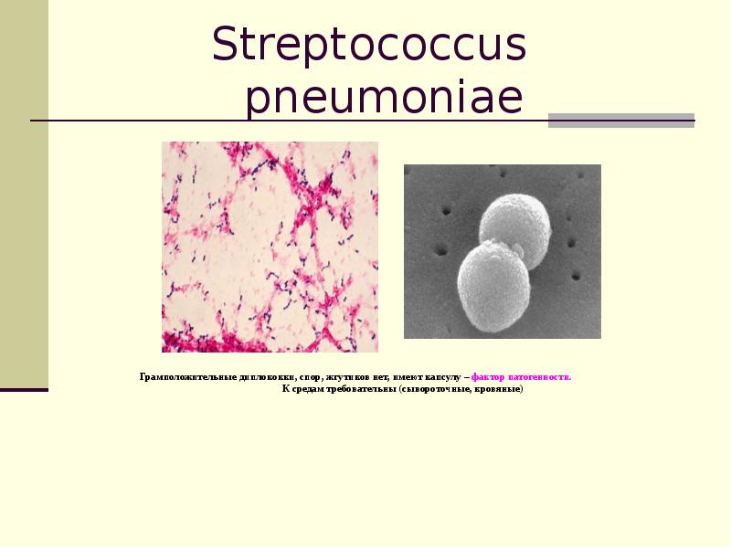 Str pneumoniae