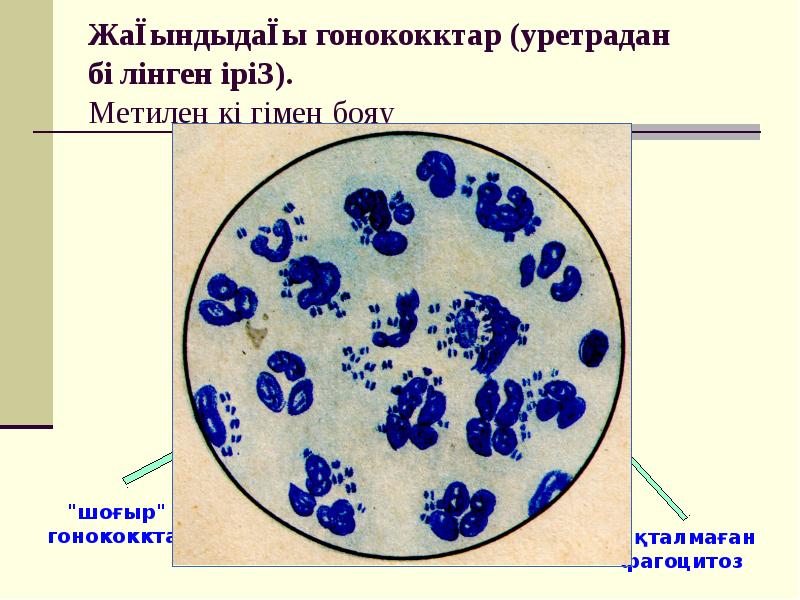 Гонококки презентация микробиология