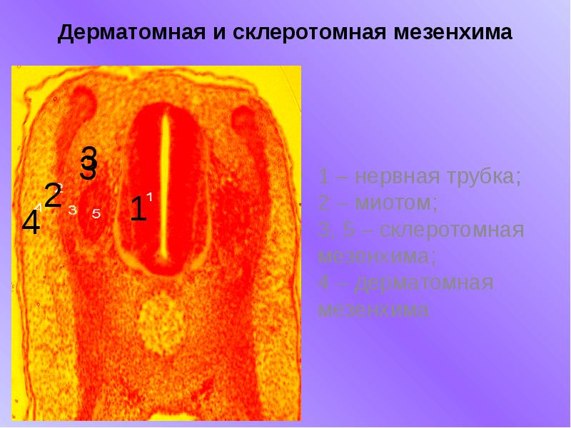 Мезенхима. Источники развития мезенхимы. Онтогенетические источники мезенхимы. Склеротомная мезенхима.