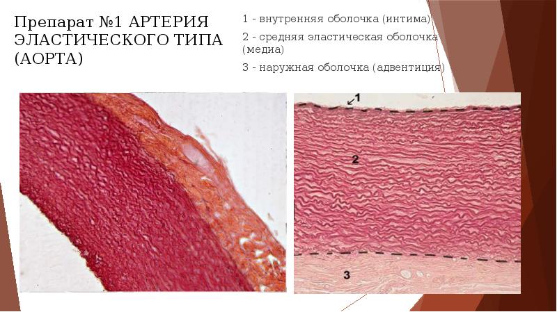 Артерии эластического типа гистология рисунок