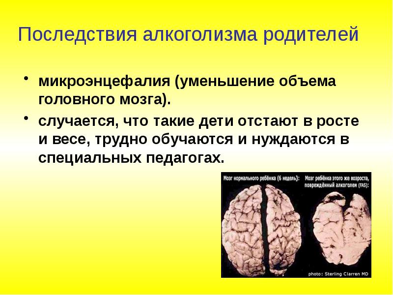 Наследственные и врожденные заболевания и заболевания передаваемые пол путем 8 класс презентация