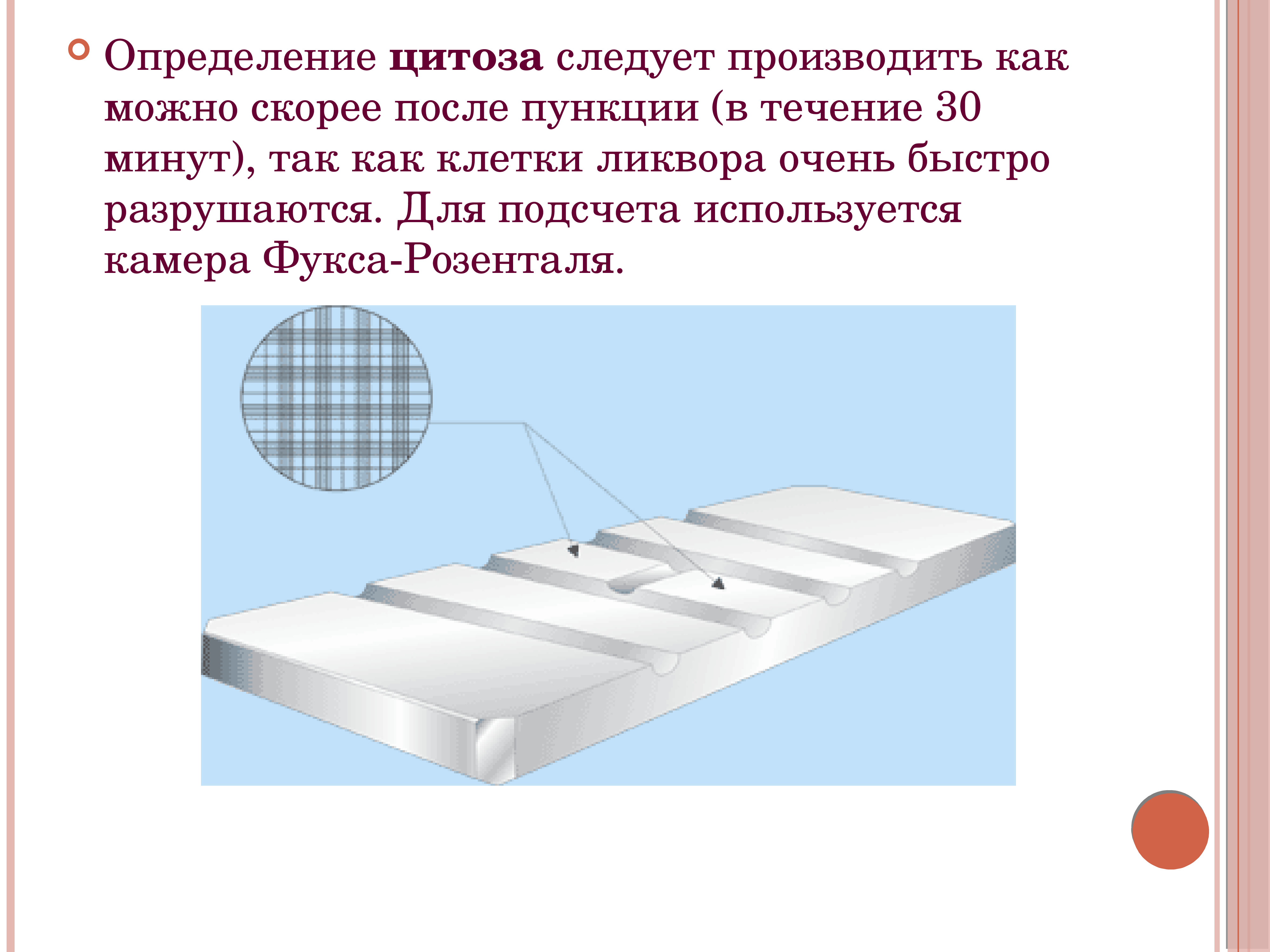 Камера для подсчета клеток в биологических образцах мочи