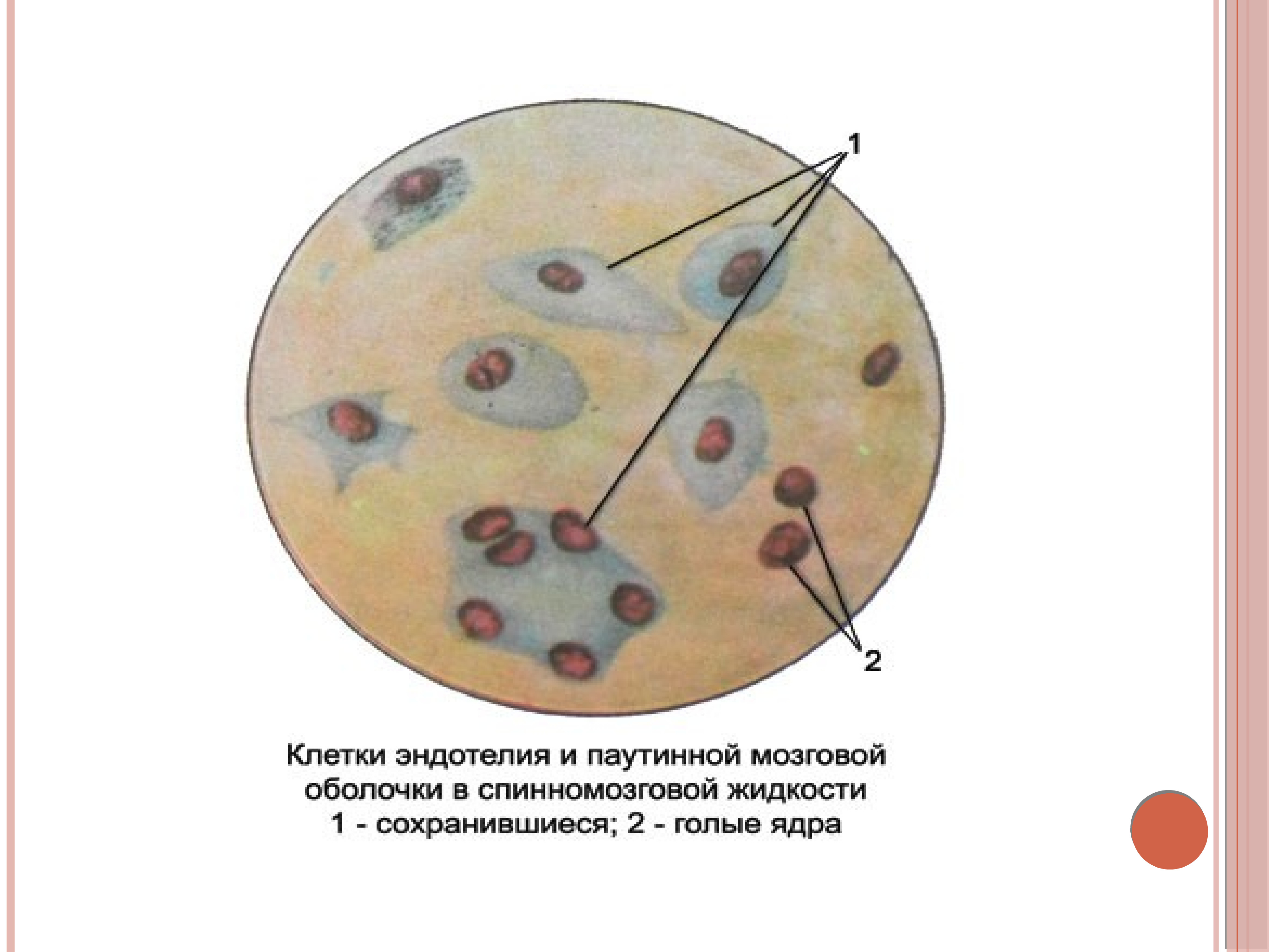 Микроскопическая картина u норма