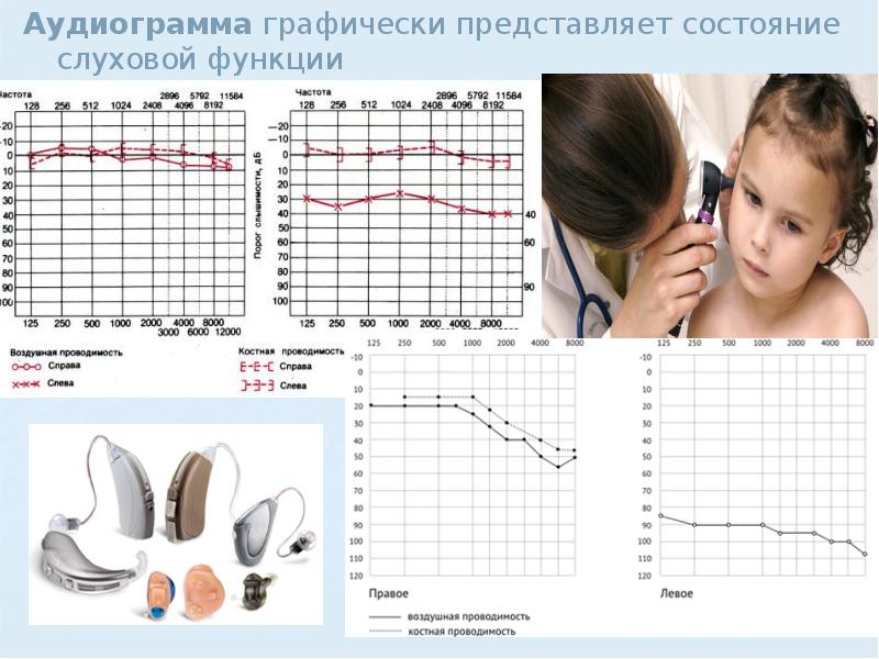 Диаграмма слуха человека