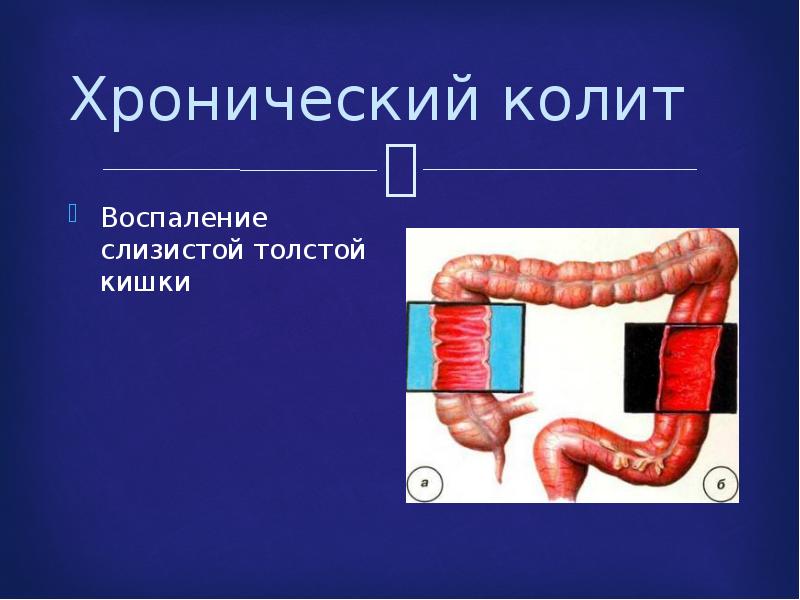 Презентация на тему энтериты и колиты