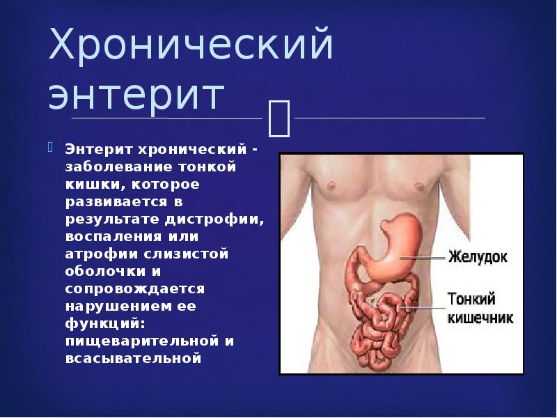 Презентация на тему энтериты и колиты