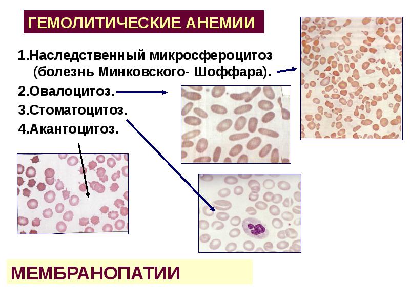 Презентации по гематологии