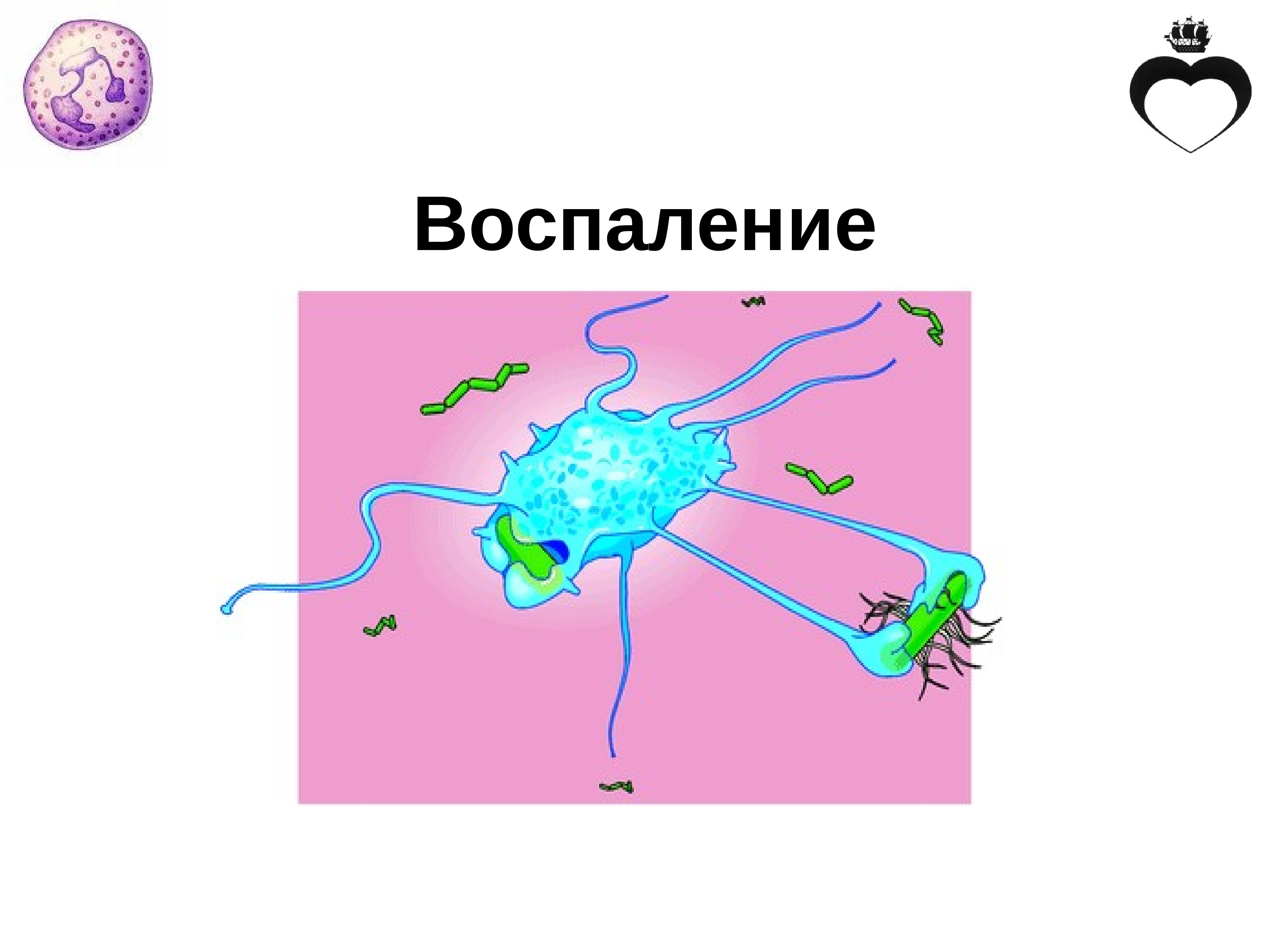 Воспаление картинки для презентации