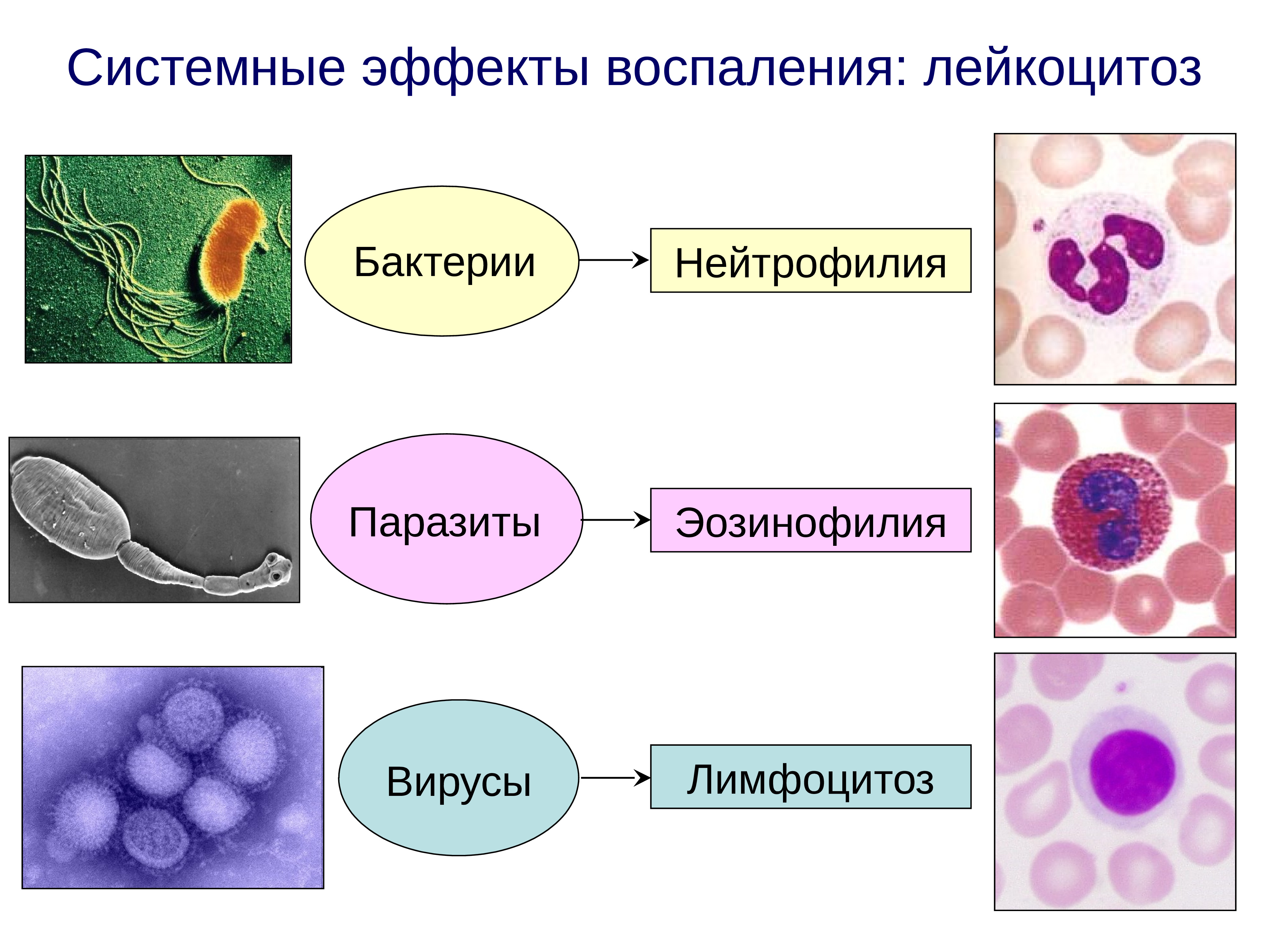 Бактерии паразиты. Презентация на тему воспаление. Нейтрофилия. Лейкоцитоз за счет гранулоцитов.