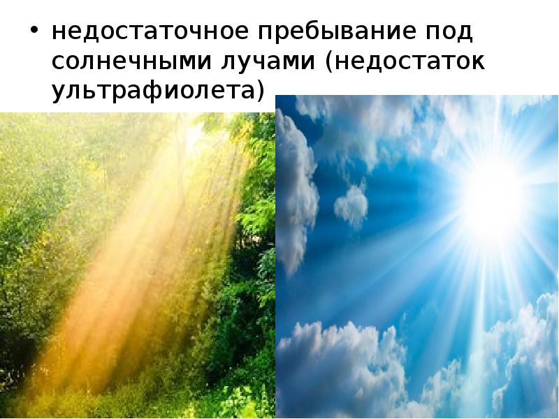 недостаточное пpебывание под солнечными лучами (недостаток ультрафиолета) недостаточное пpебывание под солнечными