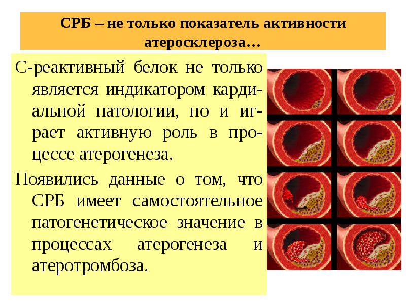 С реактивный белок презентация