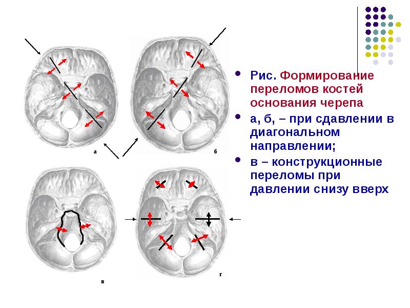 Материнский травматизм презентация