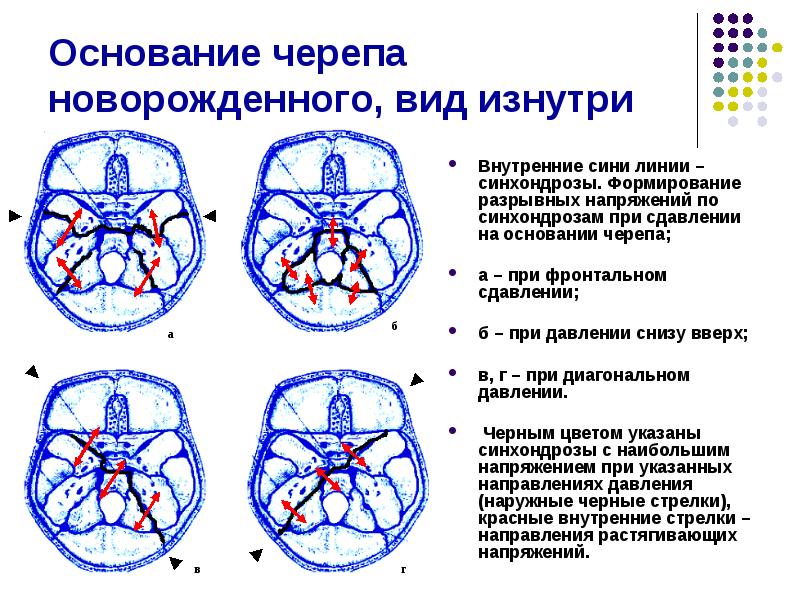 Материнский травматизм презентация