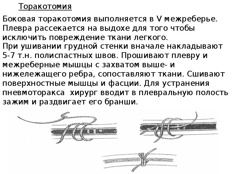 История легочной хирургии презентация