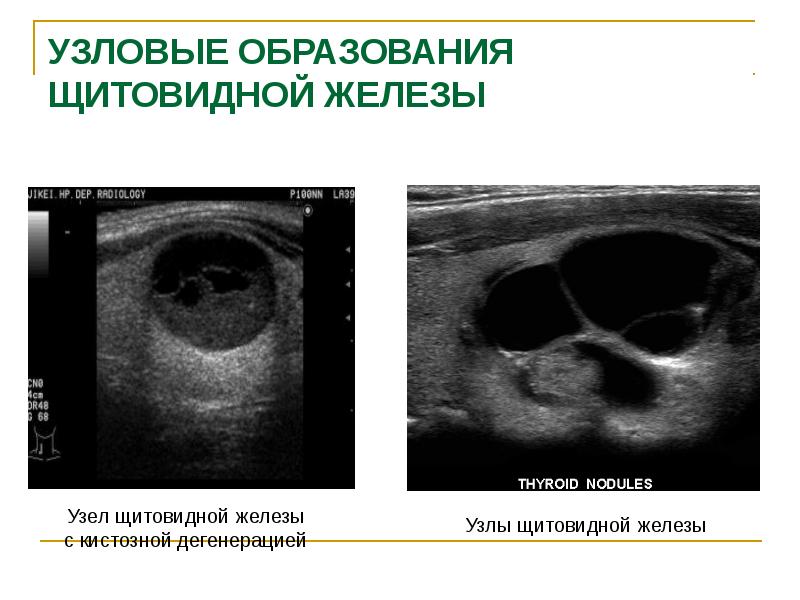 Физиология щитовидной железы презентация