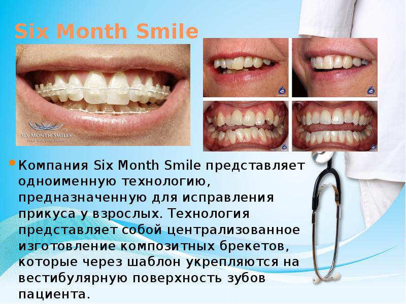 Современные методы диагностики в ортодонтии презентация