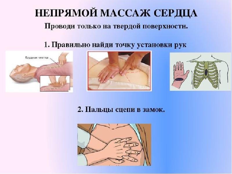 Презентация прямой массаж сердца