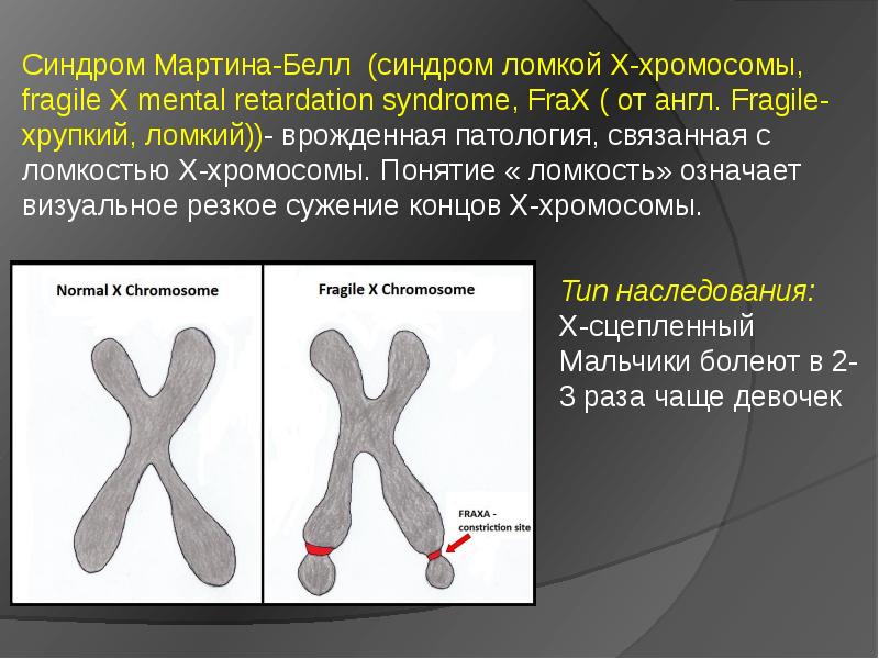 Синдром мартина белла презентация