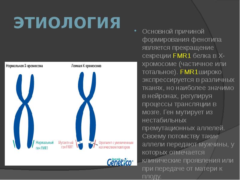 Мартин Белла Синдром Фото Детей