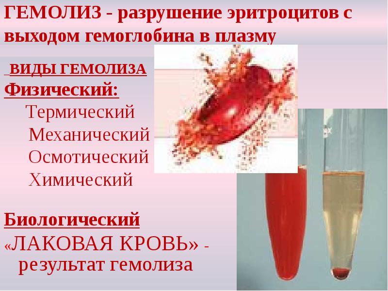ГЕМОЛИЗ - разрушение эритроцитов с выходом гемоглобина в плазму
ВИДЫ ГЕМОЛИЗ - разрушение эритроцитов с выходом гемоглобина в плазму
ВИДЫ