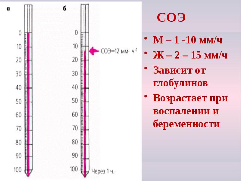 СОЭ
М – 1 -10 мм/ч
Ж – 2 – 15 СОЭ
М – 1 -10 мм/ч
Ж – 2 – 15