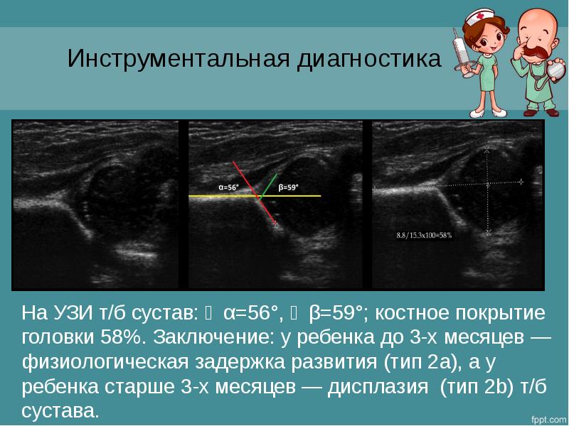 Узи суставов презентация