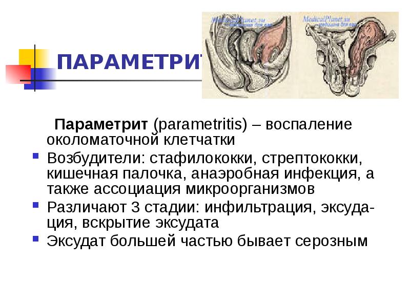 Специфические воспалительные заболевания женских органов презентация