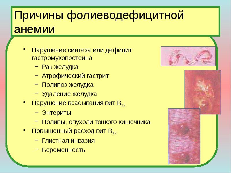 Атрофический вагинит мкб. Симптомы фолиеводефицитной анемии. Осложнения фолиеводефицитной анемии. Фолиеводефицитная анемия причины. В12 фолиеводефицитная анемия.