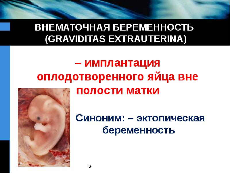 Доклад: Внематочная беременность