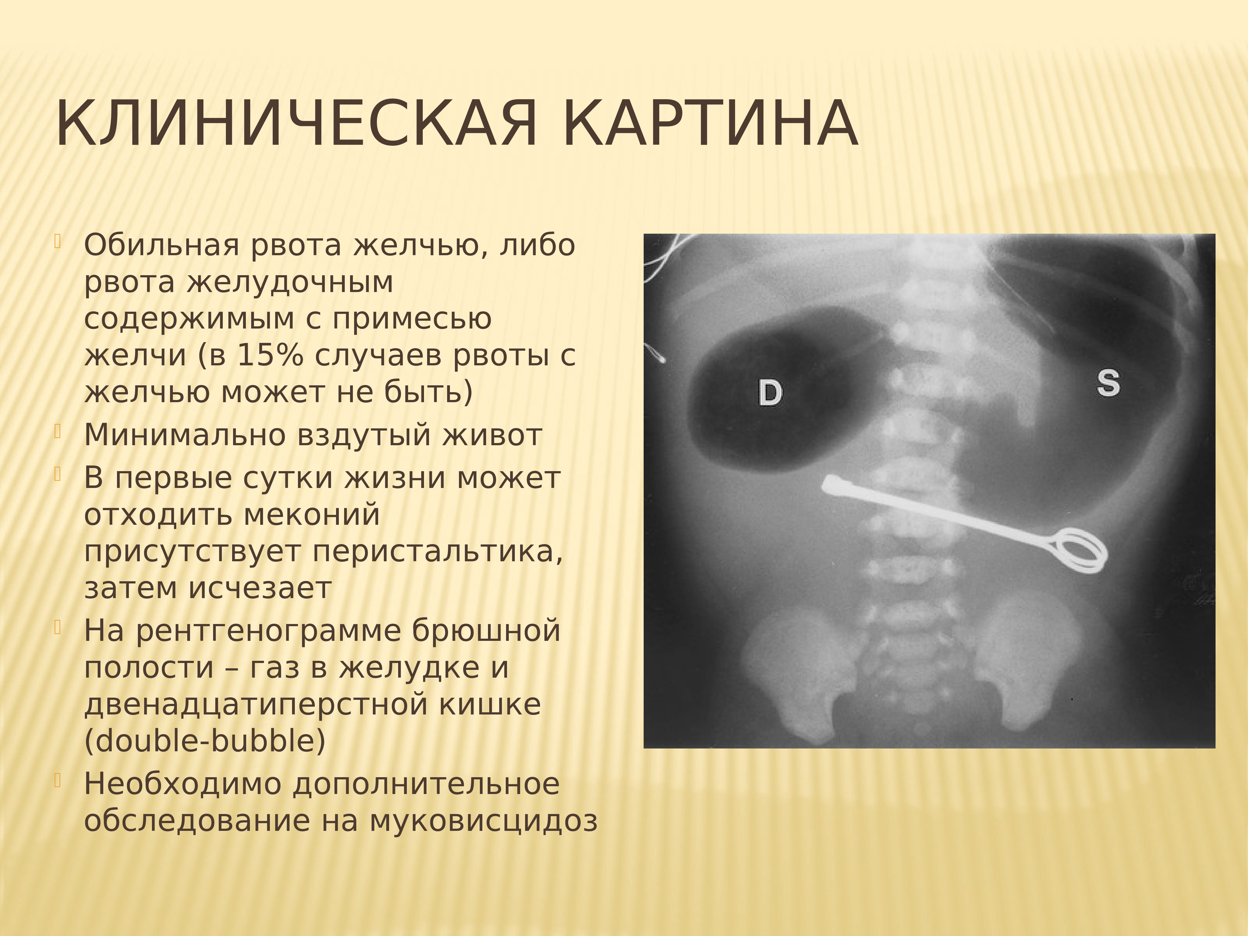 Рву желчью причины