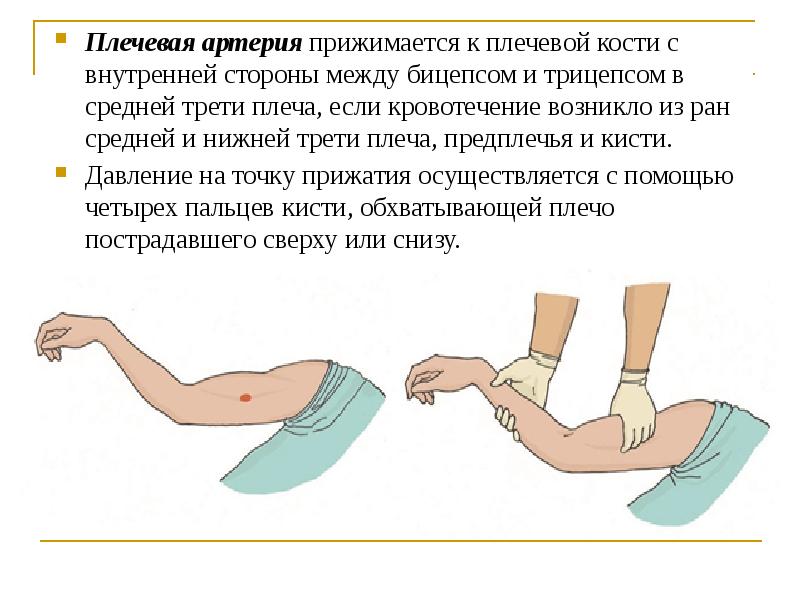 Презентация на тему виды кровотечений и способы их остановки презентация