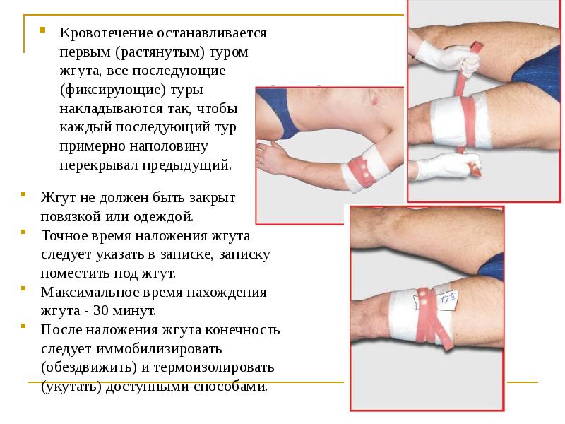 Презентация на тему виды кровотечений и способы их остановки презентация