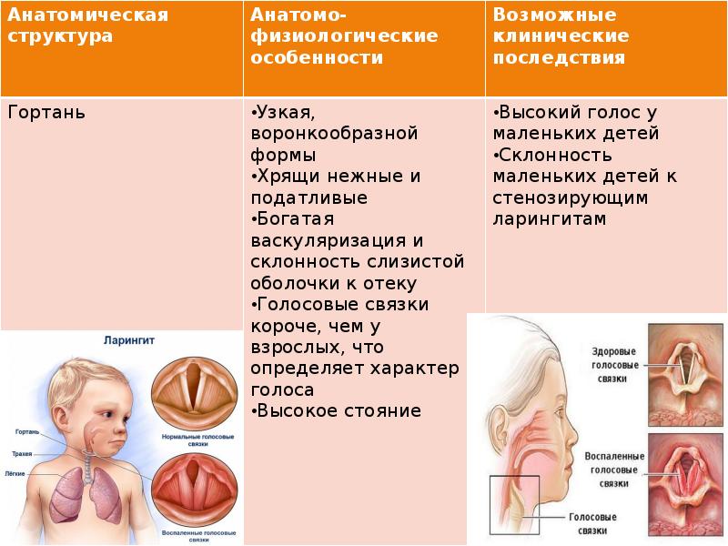 Пограничные состояния новорожденного ребенка презентация