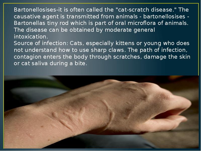 Bartonellosises-it is often called the "cat-scratch disease." The causative agent is