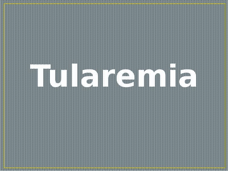 Tularemia Tularemia