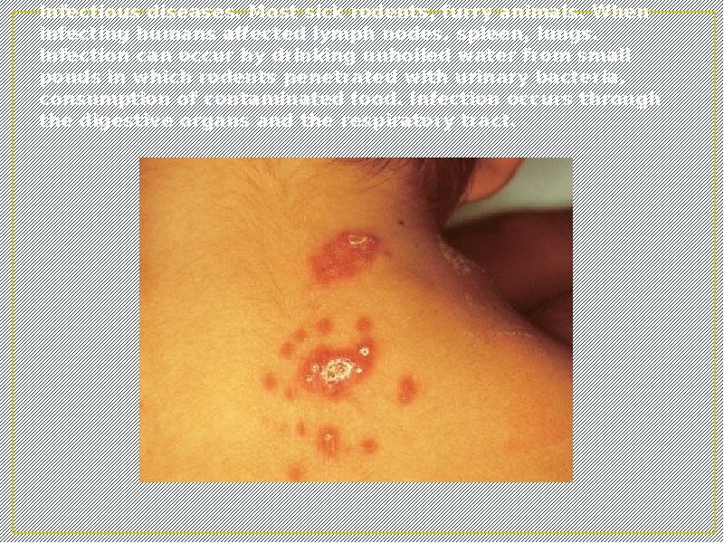 Infectious diseases. Most sick rodents, furry animals. When infecting humans affected