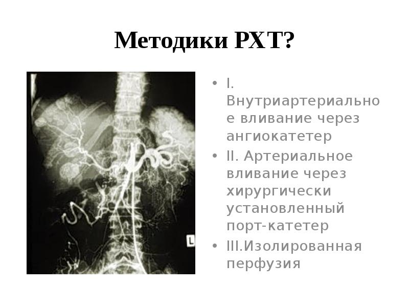 Интервенционная радиология презентация