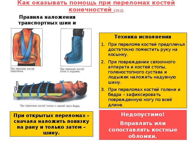 Что есть при переломах кости