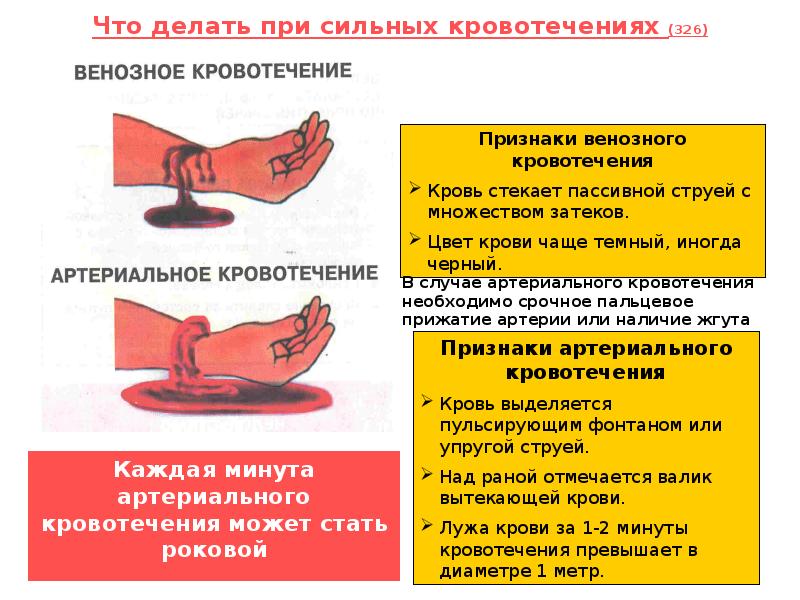 Оказание 1 медицинской помощи при носовом кровотечении. Оказание первой помощи при артериальном кровотечении. Что делать если сильное кровотечение. При сильном кровотечении. Что делать если сильное кровотечение.