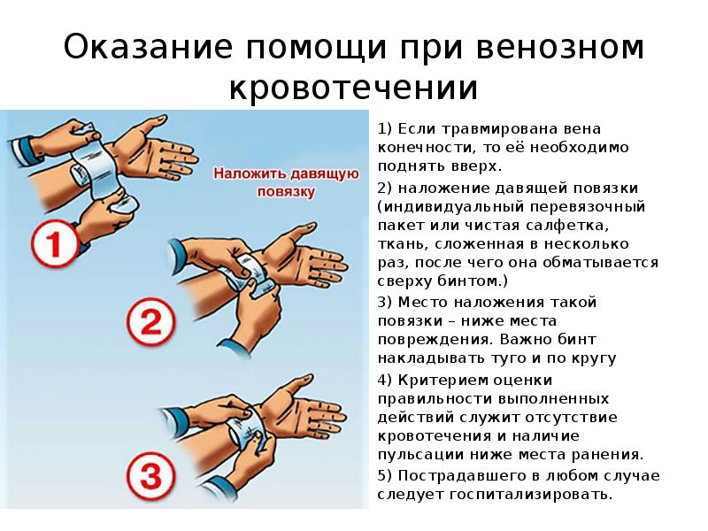 Венозное кровотечение первая помощь