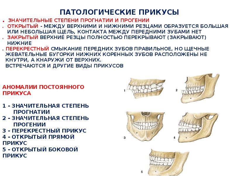 Виды прикусов презентация