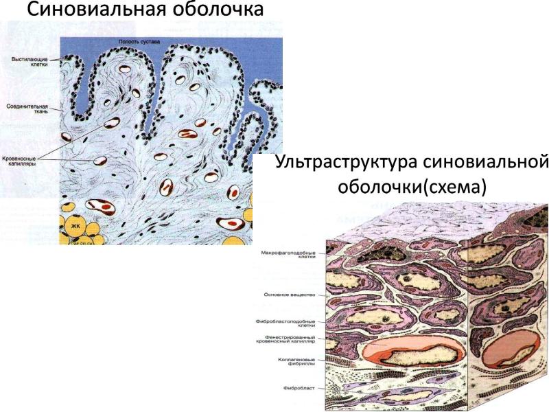 Болезни суставов презентация