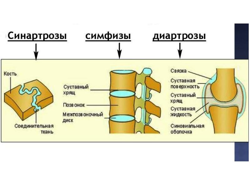 Болезни суставов презентация