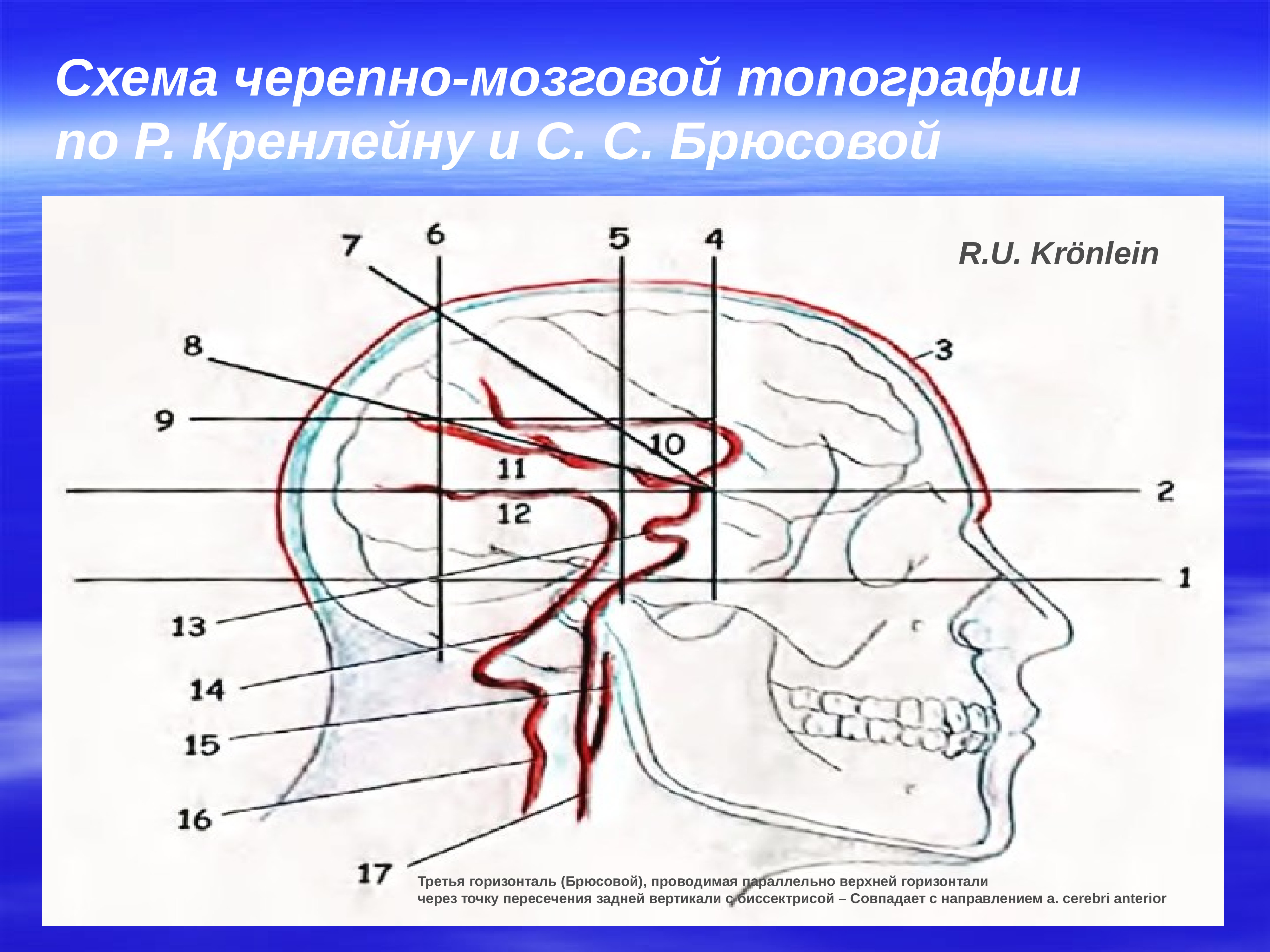 Схема кренлейна черепно мозговая