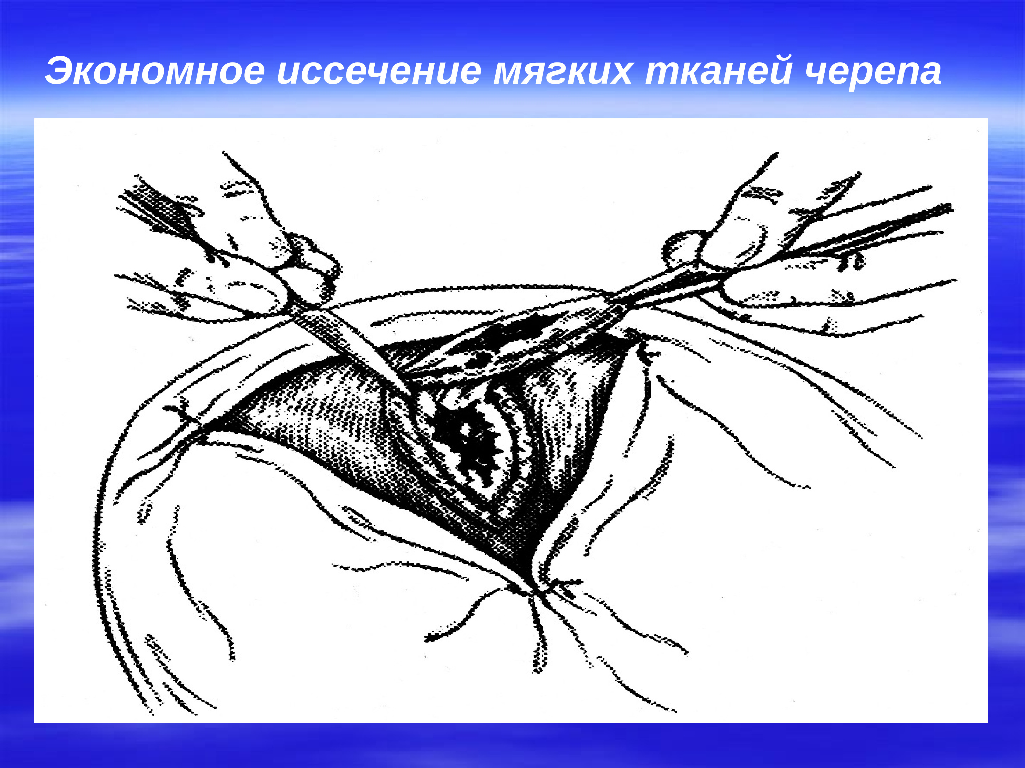 Презентация операции на голове