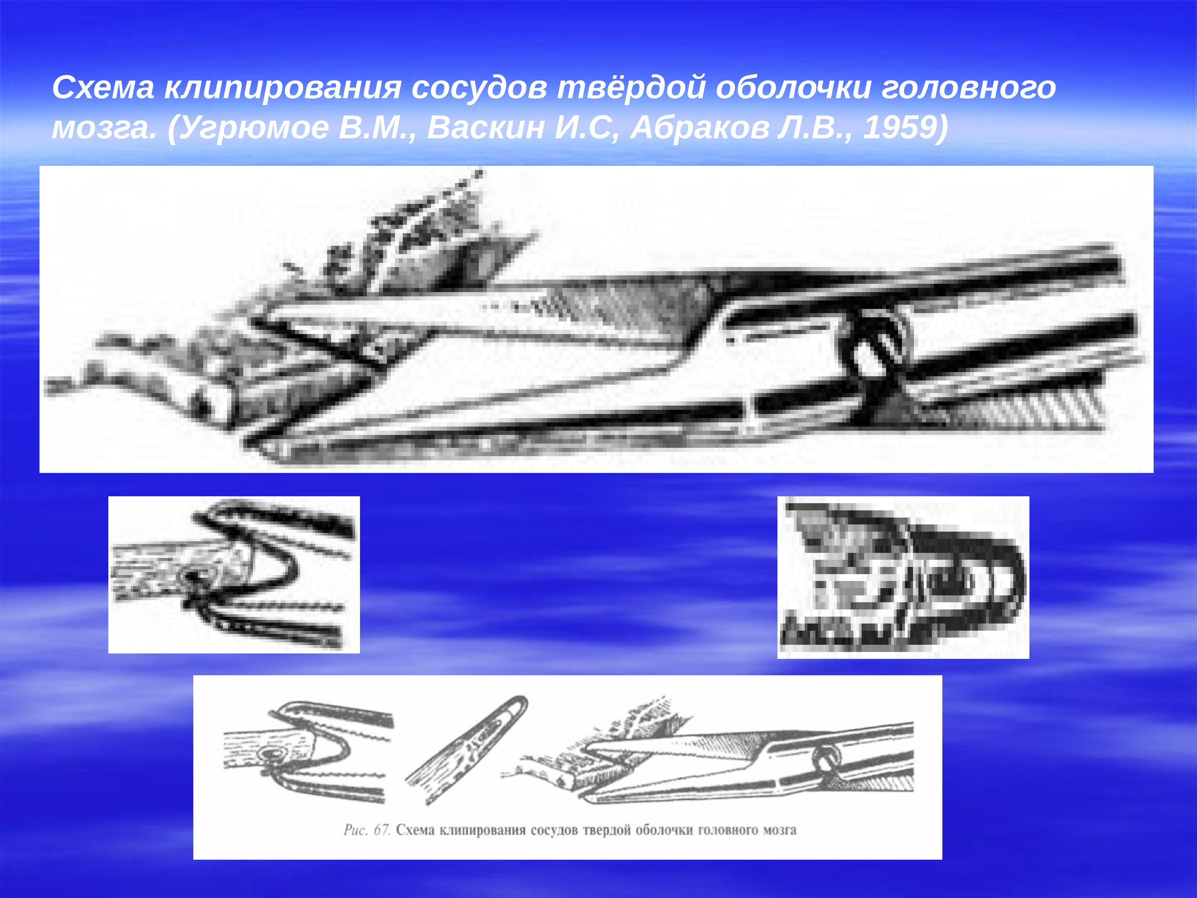 Презентация операции на голове