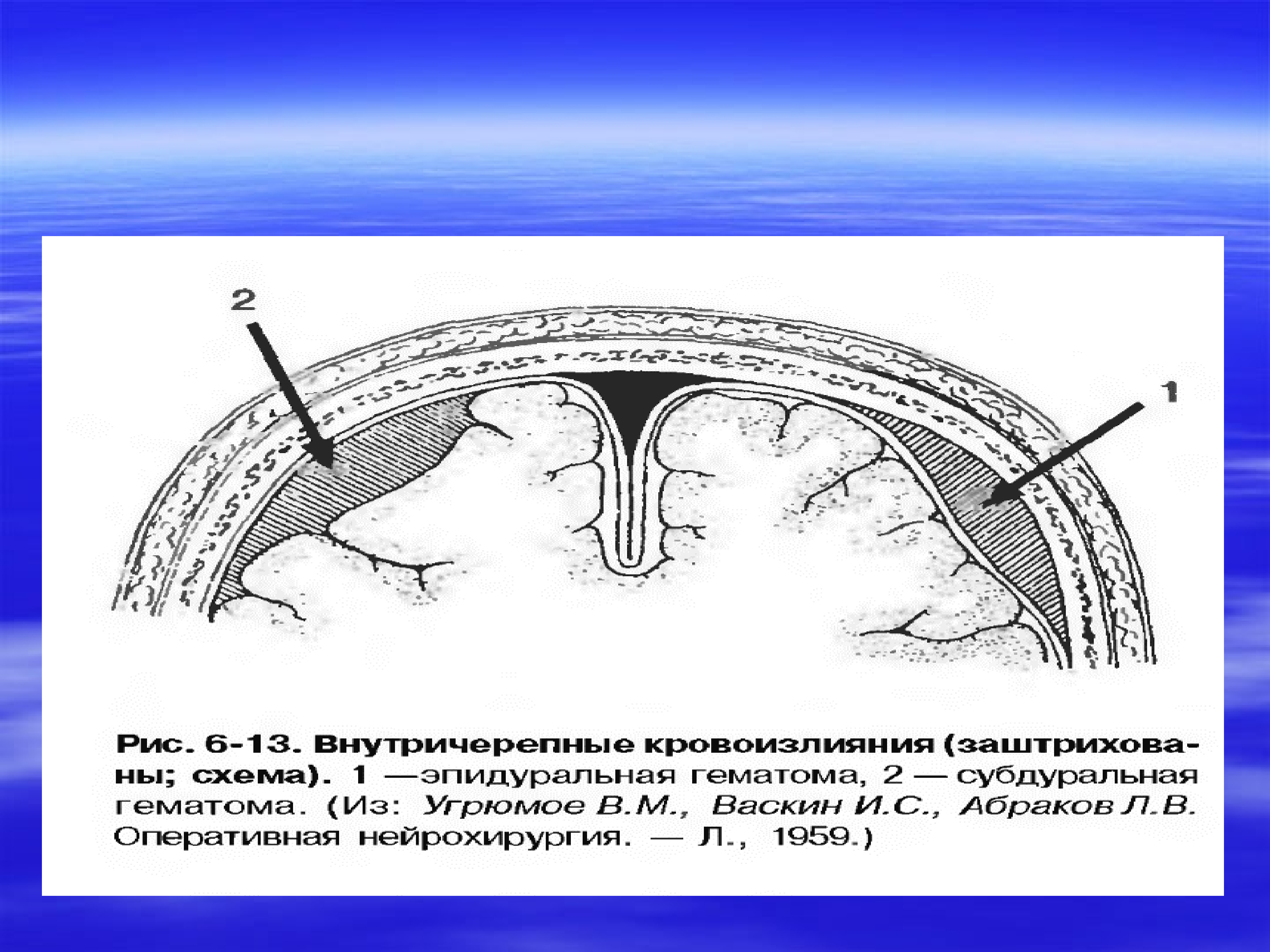 Презентация операции на голове